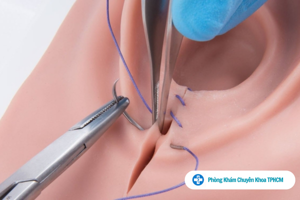 Top 11 Địa Chỉ Vá Màng Trinh Ở TPHCM Tốt Nhất Dành Cho Chị Em